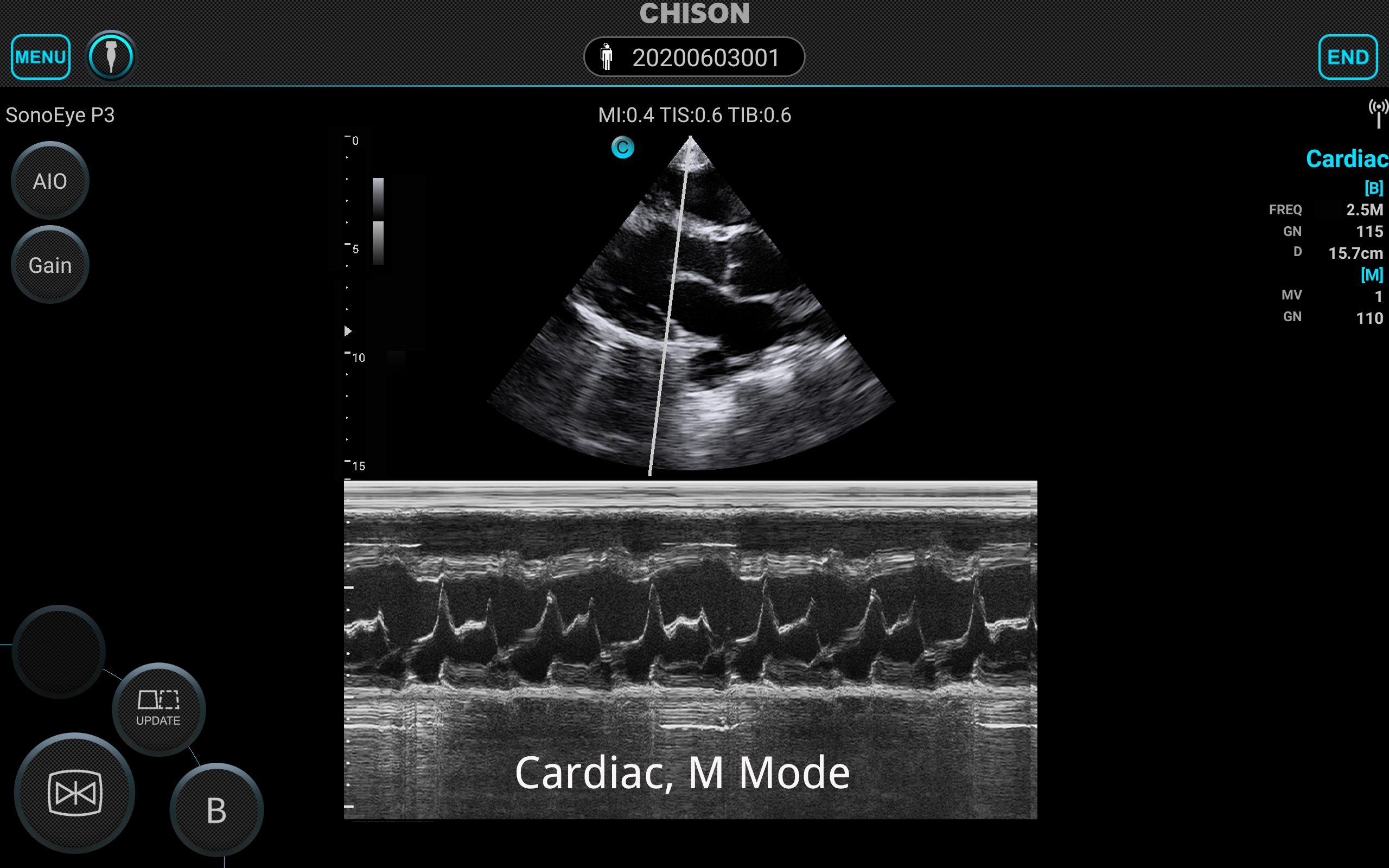 SonoEye Cardiac M Mode